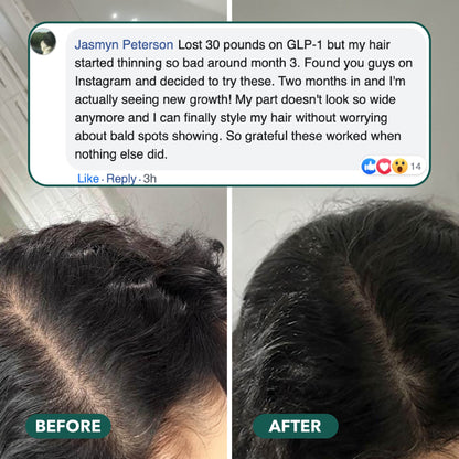 Hair Revive Gummies